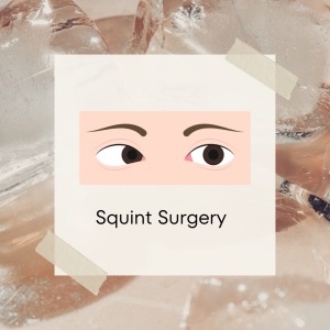 Squint Surgery
